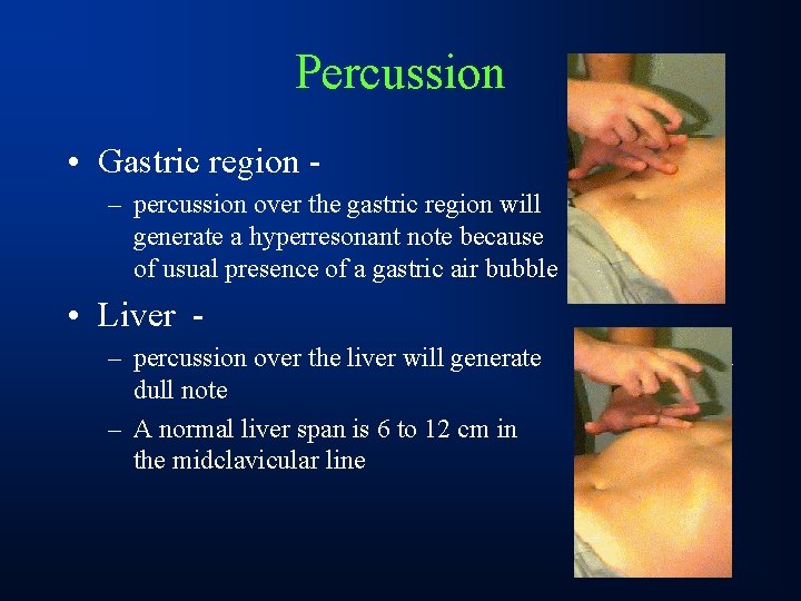 Percussion • Gastric region – percussion over the gastric region will generate a hyperresonant