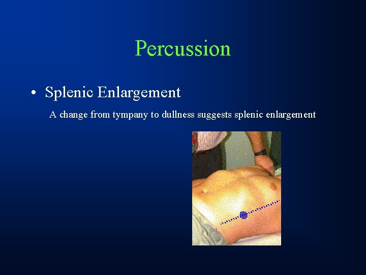 Percussion • Splenic Enlargement A change from tympany to dullness suggests splenic enlargement 