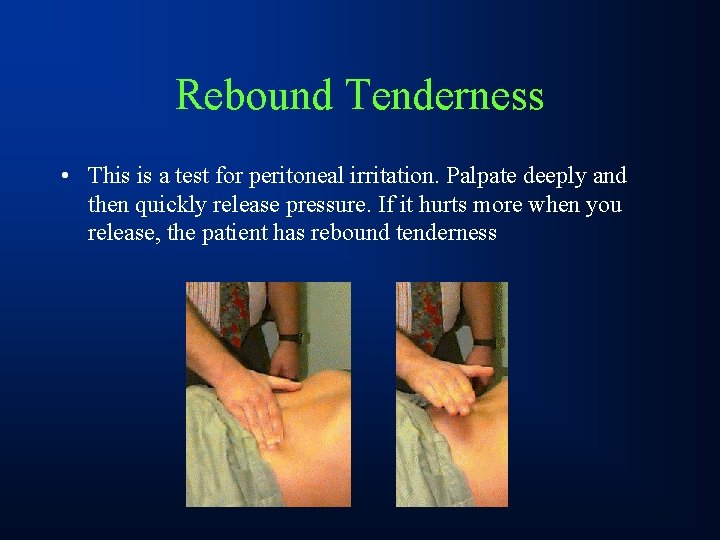 Rebound Tenderness • This is a test for peritoneal irritation. Palpate deeply and then