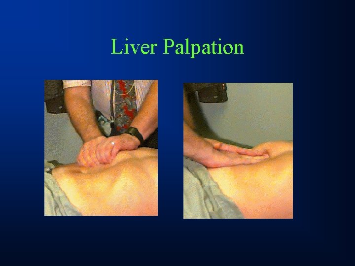 Liver Palpation 