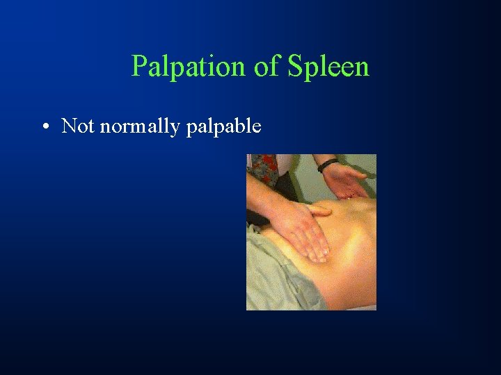 Palpation of Spleen • Not normally palpable 