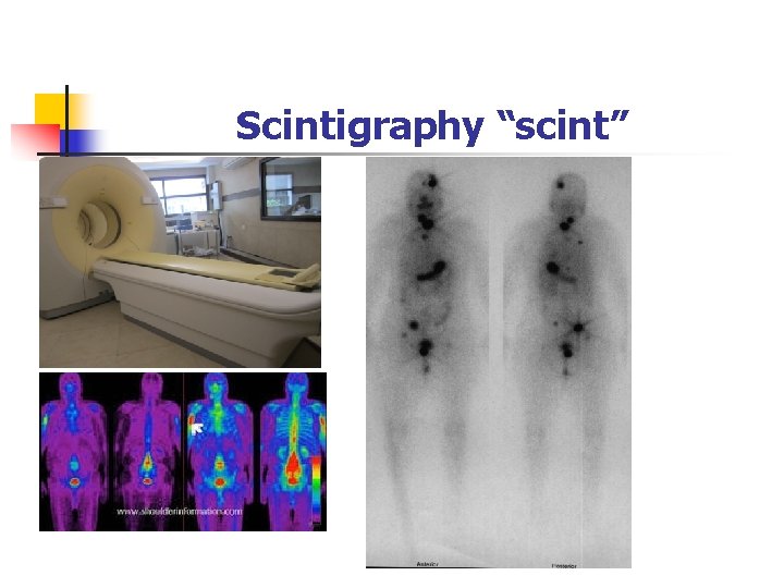 Scintigraphy “scint” 