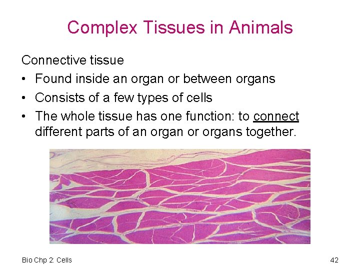 Complex Tissues in Animals Connective tissue • Found inside an organ or between organs