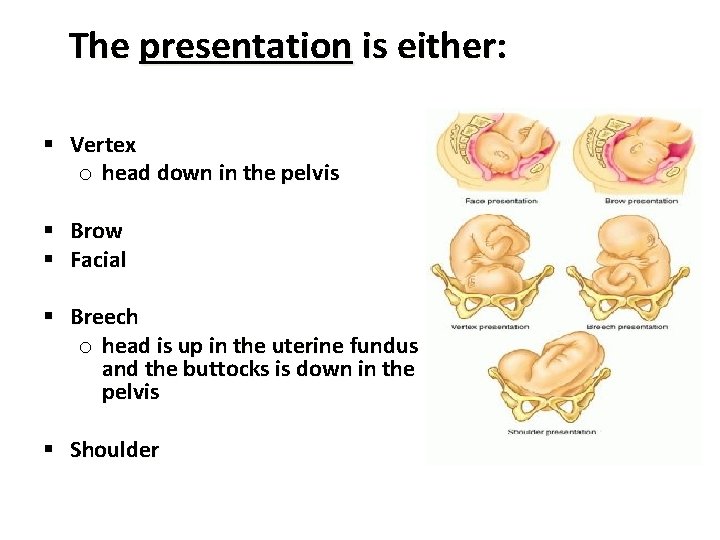 The presentation is either: § Vertex o head down in the pelvis § Brow