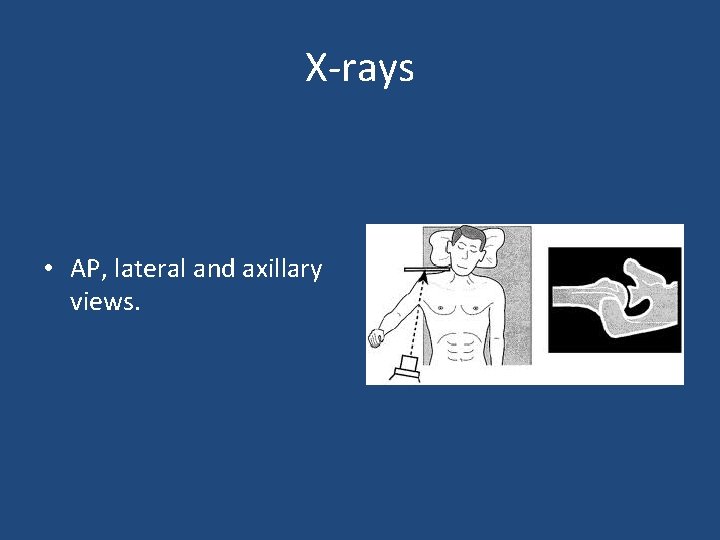 X-rays • AP, lateral and axillary views. 