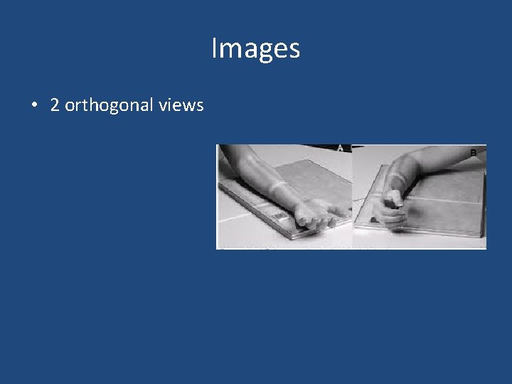 Images • 2 orthogonal views 