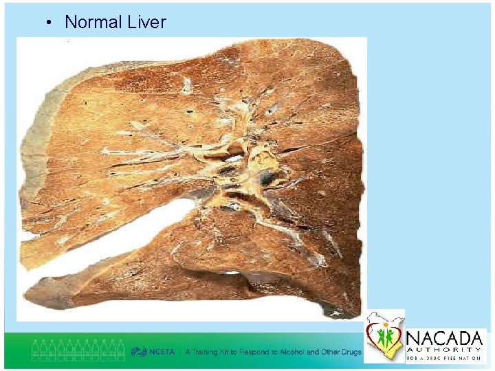  • Normal Liver 40 