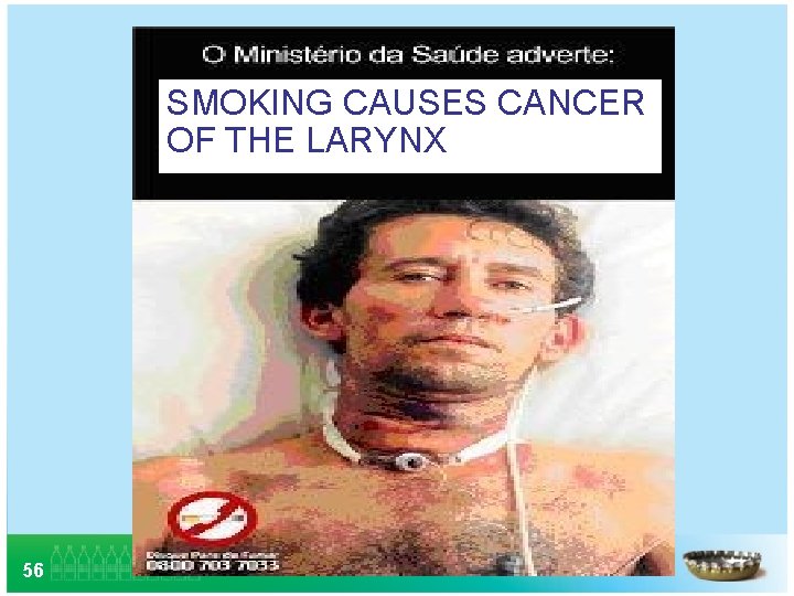 SMOKING CAUSES CANCER OF THE LARYNX 56 