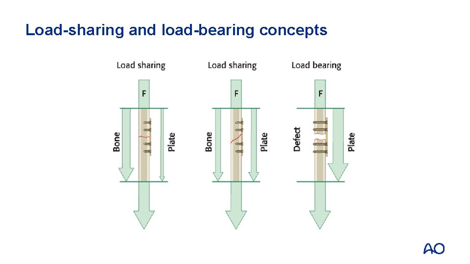 Load-sharing and load-bearing concepts 