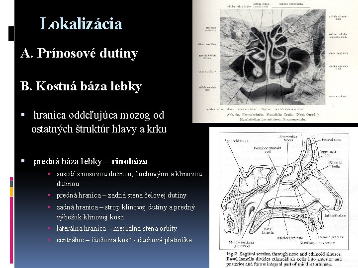 Lokalizácia A. Prínosové dutiny B. Kostná báza lebky hranica oddeľujúca mozog od ostatných štruktúr