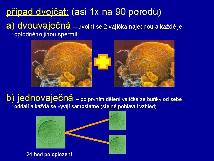 případ dvojčat: (asi 1 x na 90 porodů) a) dvouvaječná – uvolní se 2