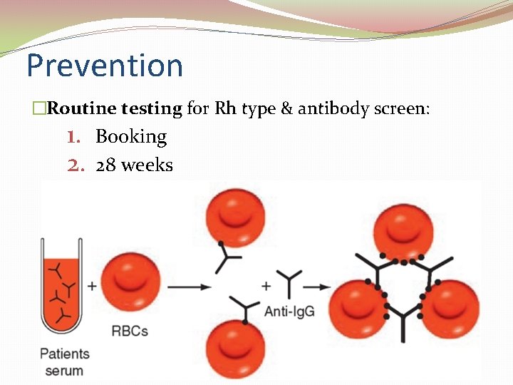 Prevention �Routine testing for Rh type & antibody screen: 1. 2. Booking 28 weeks