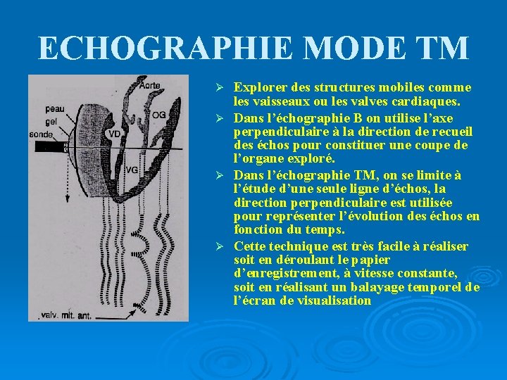 ECHOGRAPHIE MODE TM Explorer des structures mobiles comme les vaisseaux ou les valves cardiaques.