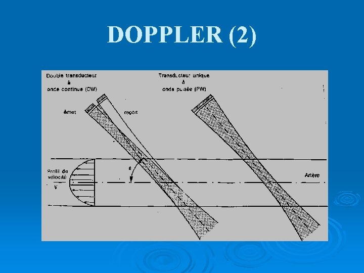 DOPPLER (2) 