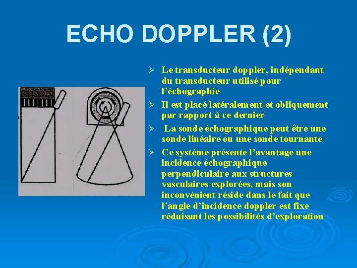 ECHO DOPPLER (2) Le transducteur doppler, indépendant du transducteur utilisé pour l’échographie Ø Il