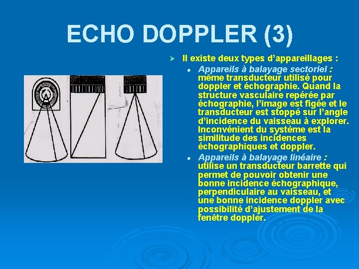 ECHO DOPPLER (3) Ø Il existe deux types d’appareillages : l Appareils à balayage