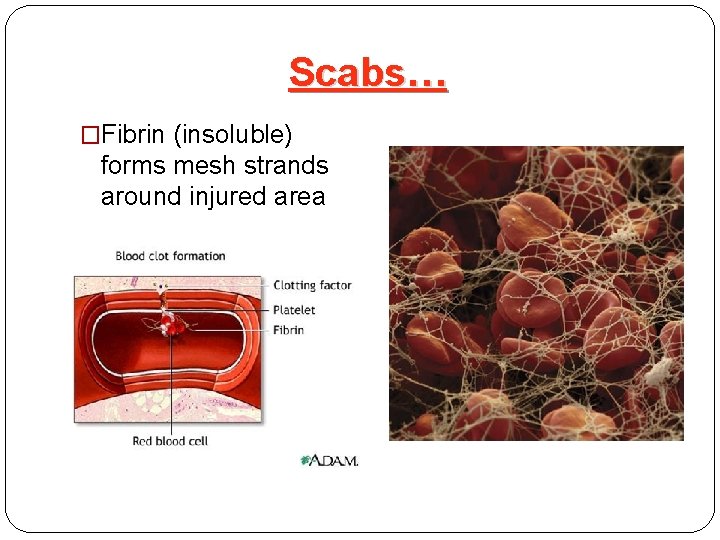 Scabs… �Fibrin (insoluble) forms mesh strands around injured area 