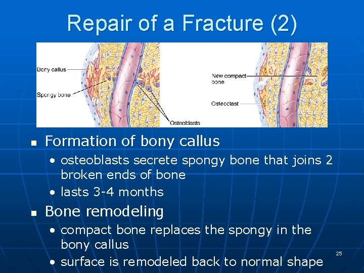 Repair of a Fracture (2) n Formation of bony callus • osteoblasts secrete spongy
