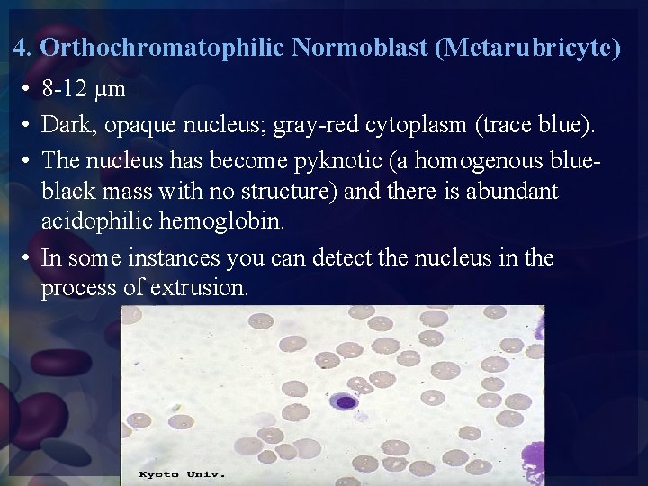 4. Orthochromatophilic Normoblast (Metarubricyte) • 8 -12 µm • Dark, opaque nucleus; gray-red cytoplasm