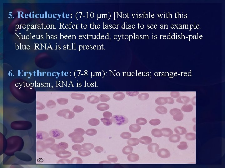 5. Reticulocyte: (7 -10 µm) [Not visible with this preparation. Refer to the laser
