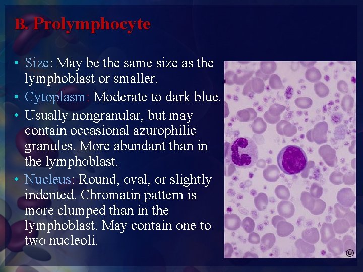 B. Prolymphocyte • Size: May be the same size as the lymphoblast or smaller.