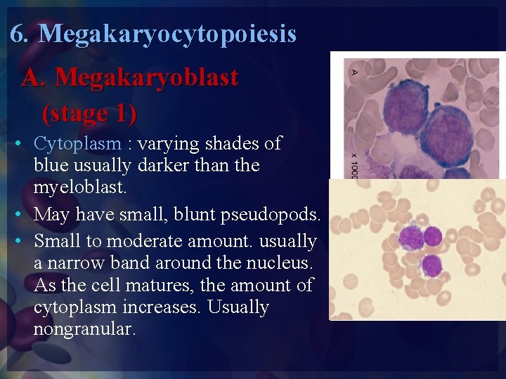 6. Megakaryocytopoiesis A. Megakaryoblast (stage 1) • Cytoplasm : varying shades of blue usually