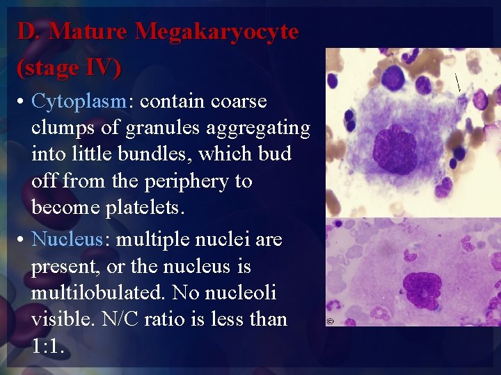 D. Mature Megakaryocyte (stage IV) • Cytoplasm: contain coarse clumps of granules aggregating into