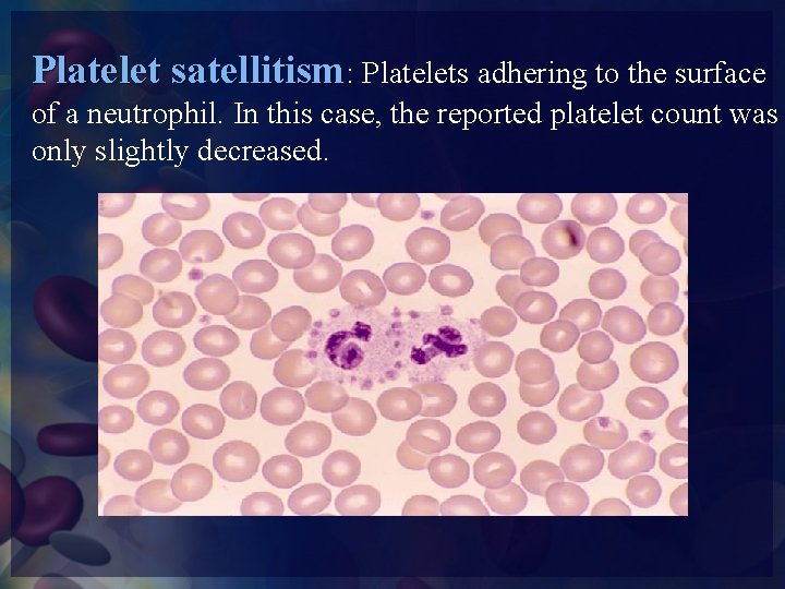 Platelet satellitism: Platelets adhering to the surface of a neutrophil. In this case, the