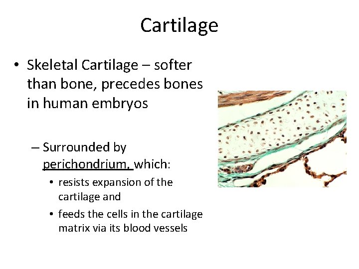 Cartilage • Skeletal Cartilage – softer than bone, precedes bones in human embryos –