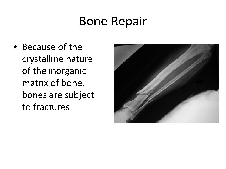 Bone Repair • Because of the crystalline nature of the inorganic matrix of bone,