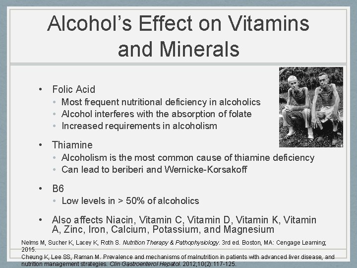 Alcohol’s Effect on Vitamins and Minerals • Folic Acid • Most frequent nutritional deficiency