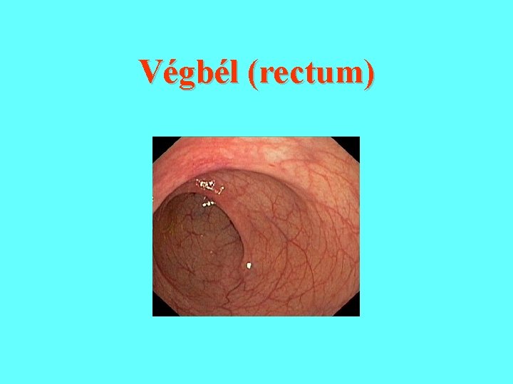 Végbél (rectum) 