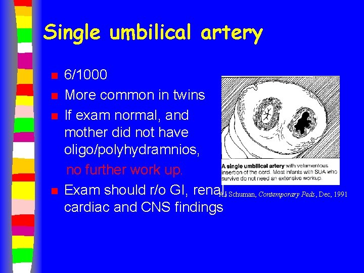 Single umbilical artery n n 6/1000 More common in twins If exam normal, and