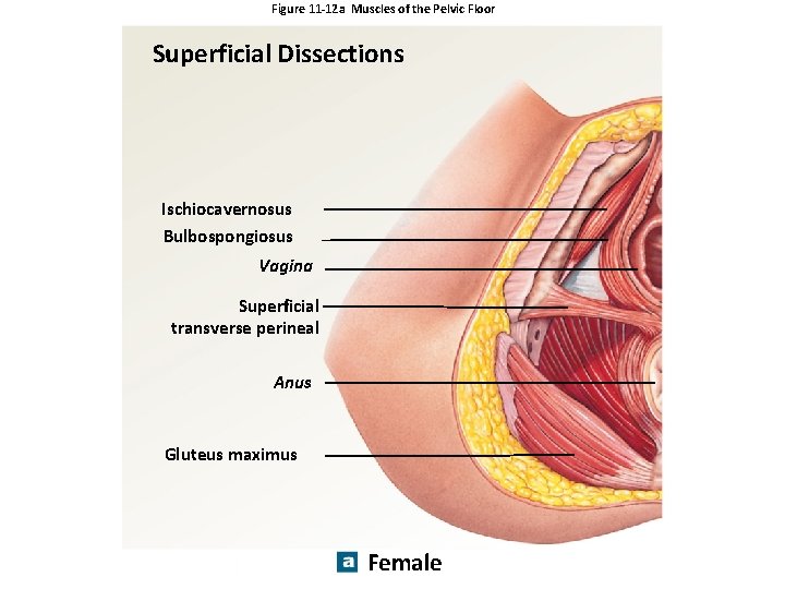 Figure 11 -12 a Muscles of the Pelvic Floor Superficial Dissections Ischiocavernosus Bulbospongiosus Vagina