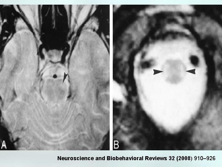 Neuroscience and Biobehavioral Reviews 32 (2008) 910– 926 
