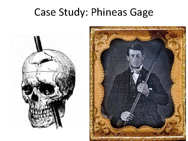 Case Study: Phineas Gage 