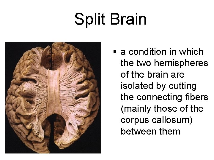 Split Brain § a condition in which the two hemispheres of the brain are