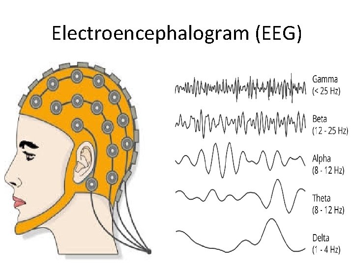 Electroencephalogram (EEG) 