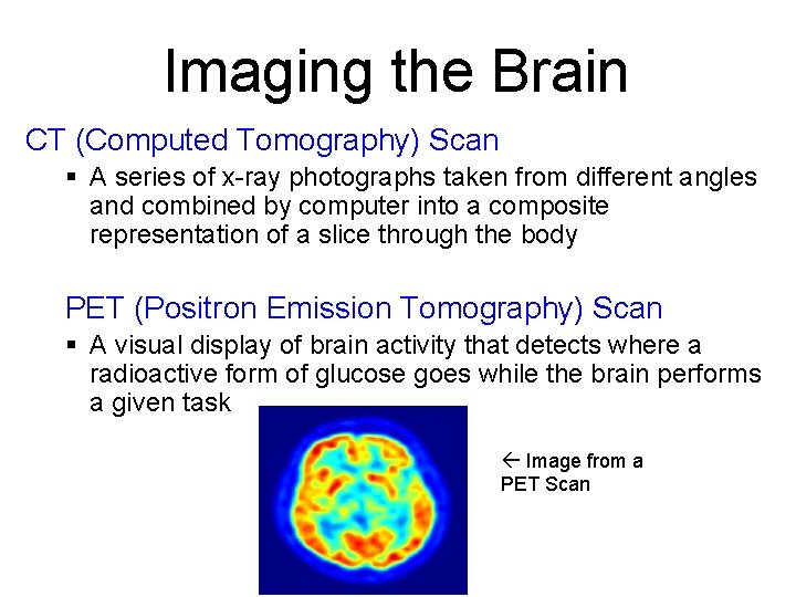 Imaging the Brain CT (Computed Tomography) Scan § A series of x-ray photographs taken