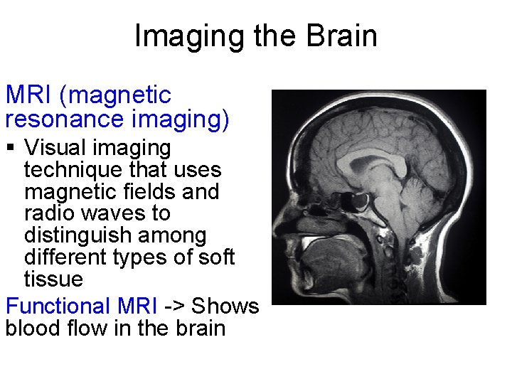 Imaging the Brain MRI (magnetic resonance imaging) § Visual imaging technique that uses magnetic