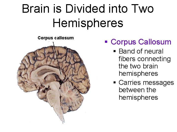 Brain is Divided into Two Hemispheres Corpus callosum § Corpus Callosum § Band of