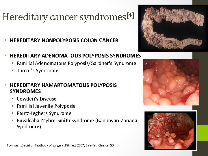 Hereditary cancer syndromes[4] • HEREDITARY NONPOLYPOSIS COLON CANCER • HEREDITARY ADENOMATOUS POLYPOSIS SYNDROMES •