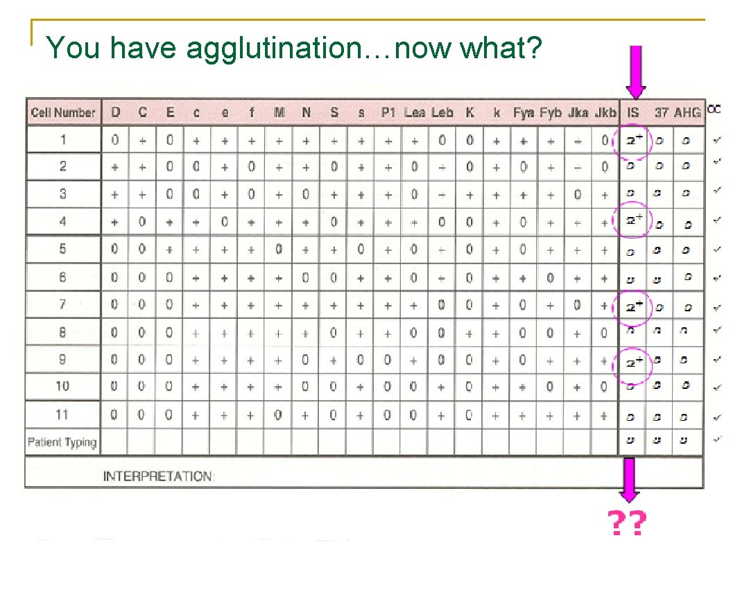 You have agglutination…now what? 