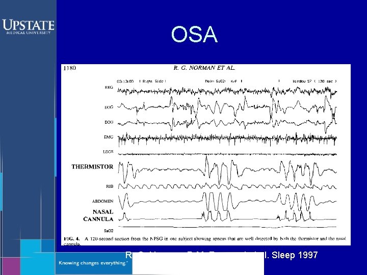 OSA R. G. Norman, D M. Rapoport et al. Sleep 1997 
