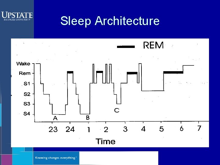 Sleep Architecture 