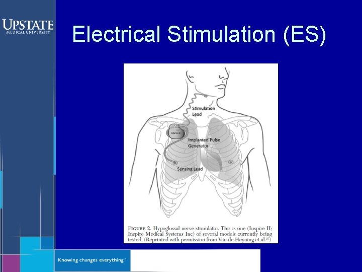 Electrical Stimulation (ES) 