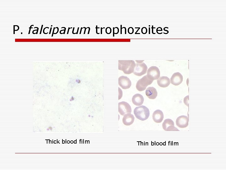 P. falciparum trophozoites Thick blood film Thin blood film 