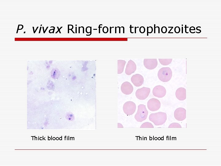 P. vivax Ring-form trophozoites Thick blood film Thin blood film 