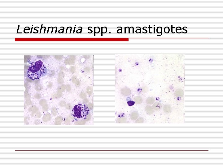 Leishmania spp. amastigotes 