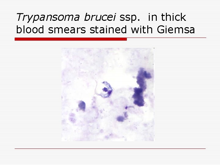Trypansoma brucei ssp. in thick blood smears stained with Giemsa 
